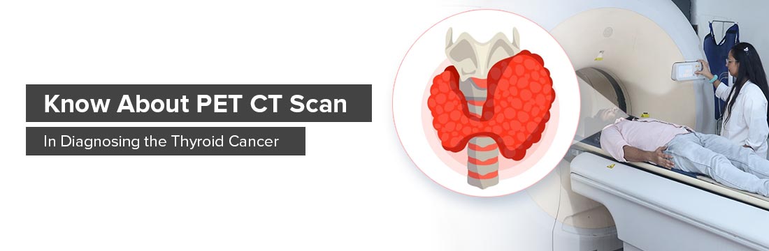 Know About PET CT Scan in Diagnosing the Thyroid Cancer